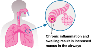 lungs